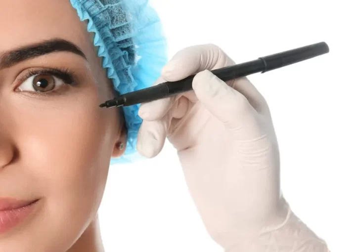Metade do rosto de uma mulher e mão de cirurgião plástico segurando um marcador