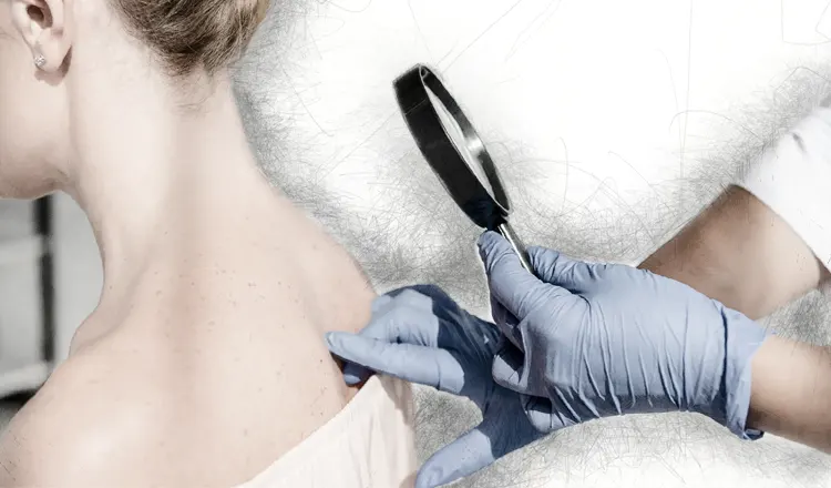 Mulher procura cirurgião plástico para verifica câncer de pele